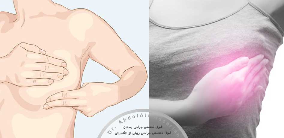تشخیص-درد-پستان