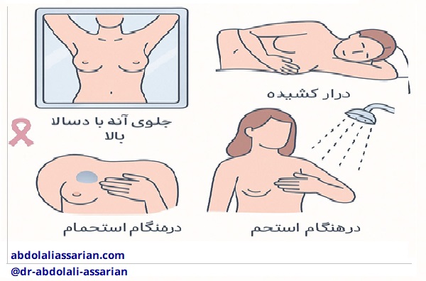 تشخیص سرطان سینه در منزل